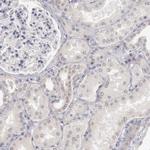 RIMBP3 Antibody in Immunohistochemistry (Paraffin) (IHC (P))