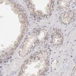 RIMBP3 Antibody in Immunohistochemistry (Paraffin) (IHC (P))