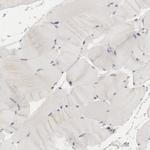 RIMBP3 Antibody in Immunohistochemistry (Paraffin) (IHC (P))