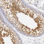 RIMBP3 Antibody in Immunohistochemistry (Paraffin) (IHC (P))