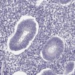 MAGEB1 Antibody in Immunohistochemistry (Paraffin) (IHC (P))