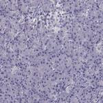 MAGEB1 Antibody in Immunohistochemistry (Paraffin) (IHC (P))