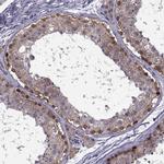 MAGEB1 Antibody in Immunohistochemistry (Paraffin) (IHC (P))