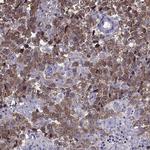 MAGEB1 Polyclonal Antibody