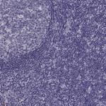 MAGEB1 Antibody in Immunohistochemistry (Paraffin) (IHC (P))