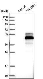 MAGEB1 Antibody in Western Blot (WB)