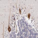 RNF139 Antibody in Immunohistochemistry (Paraffin) (IHC (P))