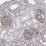 RNF139 Antibody in Immunohistochemistry (Paraffin) (IHC (P))