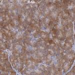 RNF139 Polyclonal Antibody