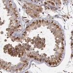 RNF139 Antibody in Immunohistochemistry (IHC)