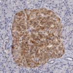 TMED8 Polyclonal Antibody