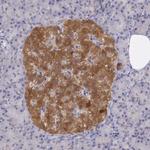 Pleckstrin 2 Antibody in Immunohistochemistry (Paraffin) (IHC (P))
