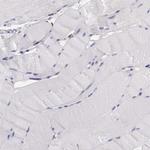 Pleckstrin 2 Antibody in Immunohistochemistry (Paraffin) (IHC (P))