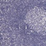 Pleckstrin 2 Antibody in Immunohistochemistry (IHC)
