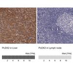 Pleckstrin 2 Antibody