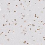 UNC84B Antibody in Immunohistochemistry (IHC)