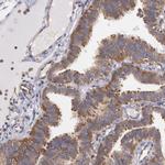DRG1 Antibody in Immunohistochemistry (IHC)