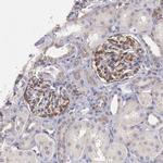 DRG1 Antibody in Immunohistochemistry (IHC)