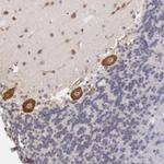 DRG1 Antibody in Immunohistochemistry (IHC)
