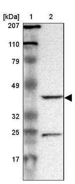 DRG1 Antibody in Western Blot (WB)