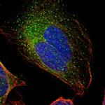 GAL3ST1 Polyclonal Antibody