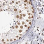 DGCR14 Antibody in Immunohistochemistry (IHC)