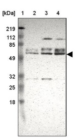 DGCR14 Antibody in Western Blot (WB)