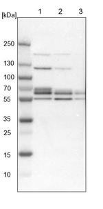 DGCR14 Antibody in Western Blot (WB)