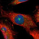 CBS Polyclonal Antibody