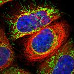 MPST Polyclonal Antibody