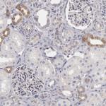 RGAG1 Antibody in Immunohistochemistry (IHC)