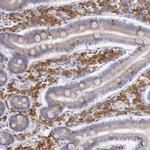 CIDEB Antibody in Immunohistochemistry (Paraffin) (IHC (P))