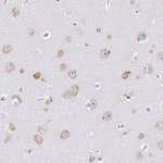 CIDEB Antibody in Immunohistochemistry (Paraffin) (IHC (P))