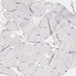CIDEB Antibody in Immunohistochemistry (Paraffin) (IHC (P))