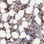 FCN1 Antibody in Immunohistochemistry (Paraffin) (IHC (P))