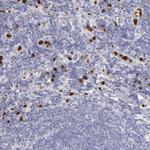 FCN1 Polyclonal Antibody