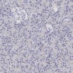FCN1 Antibody in Immunohistochemistry (Paraffin) (IHC (P))