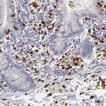 FCN1 Antibody in Immunohistochemistry (Paraffin) (IHC (P))