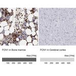 FCN1 Antibody in Immunohistochemistry (IHC)