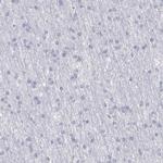 FCN1 Antibody in Immunohistochemistry (IHC)