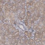 ORP8 Polyclonal Antibody