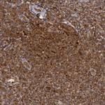 TAP2 Polyclonal Antibody