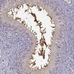 EDDM3B Polyclonal Antibody