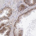 Syntaxin 4 Antibody in Immunohistochemistry (Paraffin) (IHC (P))