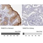 RAB27A Polyclonal Antibody