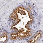 RAB27A Antibody in Immunohistochemistry (IHC)