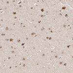 DNA ligase IV Antibody in Immunohistochemistry (IHC)