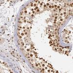 DNA ligase IV Antibody in Immunohistochemistry (IHC)