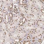 DNA ligase IV Antibody in Immunohistochemistry (IHC)