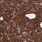 STX5 Antibody in Immunohistochemistry (Paraffin) (IHC (P))